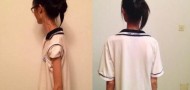 Suzhou anorexia nervosa